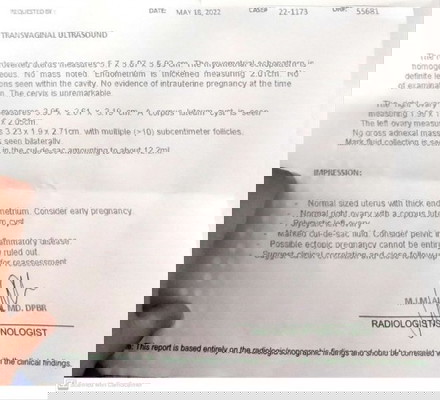 Paliwanagan naman po ako mga sis... Salamat po