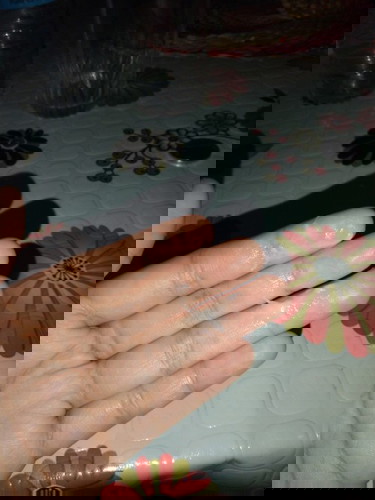 Pregnancy discharge or infection