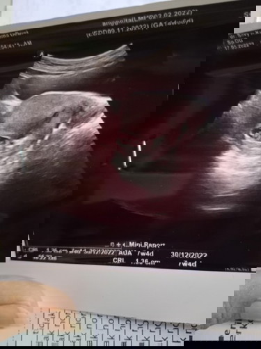 Jangan salfok sama hpht nya ya bun, itu mbak mbaknya salah masukin hpht hehe