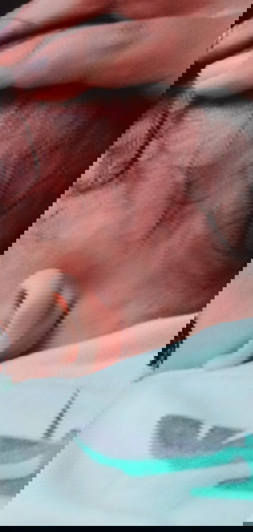 Bun , adakah yg sama di belakang telinga , kepala anak saya ada benjolan tpi lebih dari satu