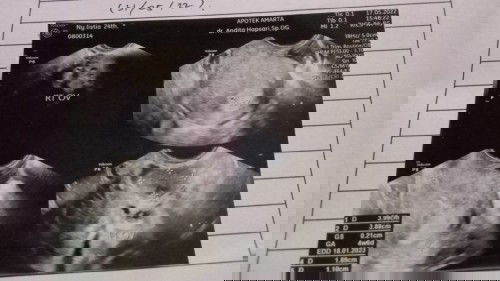 Ass.serius nanya barang kali ada yang pernah sama ngalamin seperti yang d alami saya sekarang