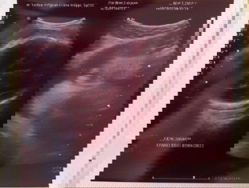 Hpl 2juni 37 week 6 day