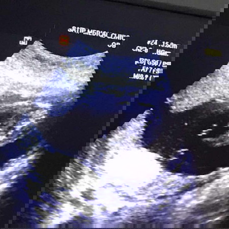 ผู้ชายหรือผู้หญิงคะ