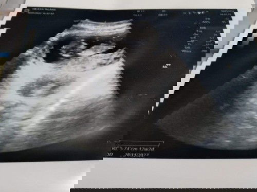 12W2D หนูโตไวมาก