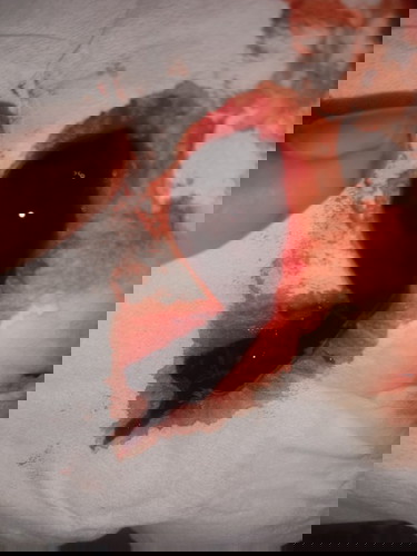 Tanya bunda ini apa yh Bun? Janin kah atau gumpalan darah biasa.. soalnya haid kamrin² nggak teratur