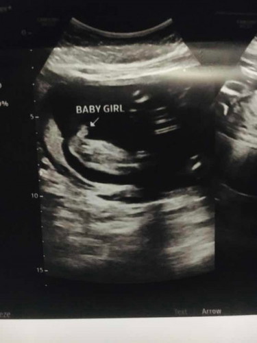 Gender: Boy or Girl?