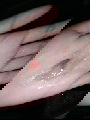 #38+4วีค มูกเลือดท้องแข็งถี่เจ็บแต่ไม่ปวดท้อง