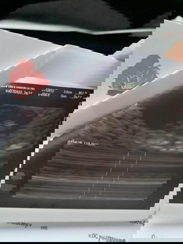 Embryo and heartbeat