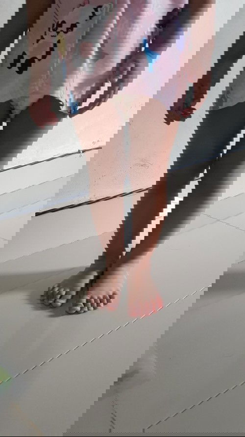 Kaki anak saya kaki X bukan ya?