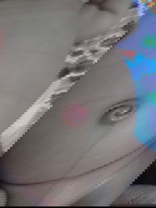 Puser basah dan memerah