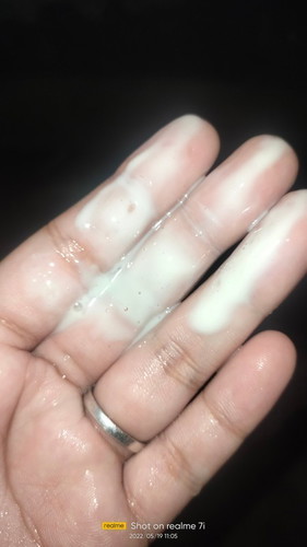 Discharge , normal lang po ba ito?