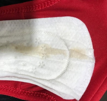 Keputihan kat pantyliner