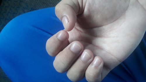 Is it Normal?