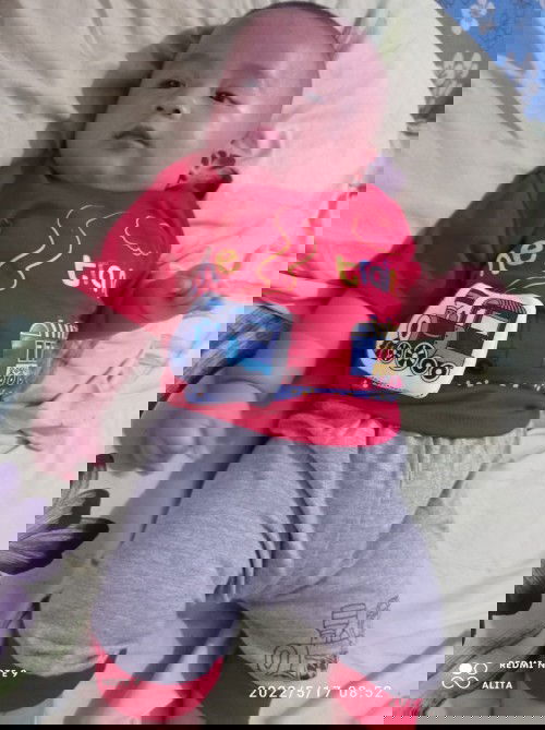 KB IUD bayi usia 3bln