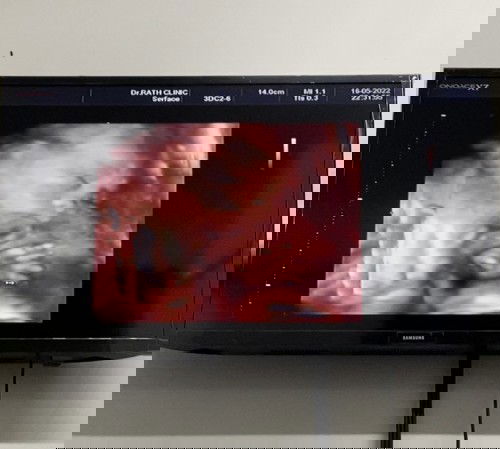 อัลตร้าซาวด์4D ตอนคลอดน้องหน้าเหมือนที่ซาวด์กันมั้ยค่ะ