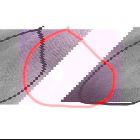 White Discharge. Normal lang ba?