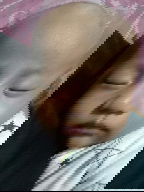 Apakah dehidrasi atau bukan