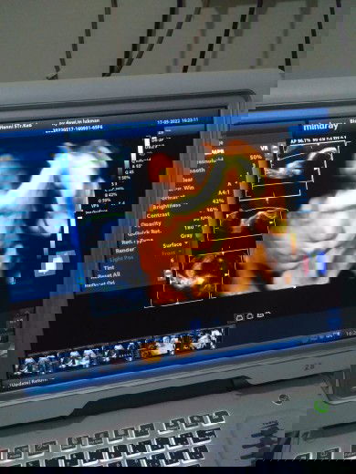 Ada yg sama hpl agustus