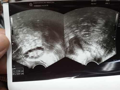 อยากถามค่ะ