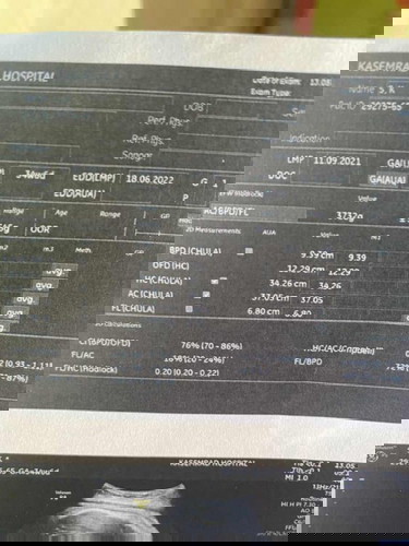 สอบถามแม่ๆค่ะ