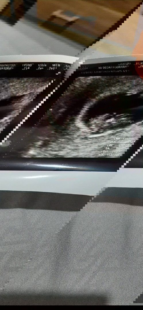 Usg ke 2,minggu ke 9