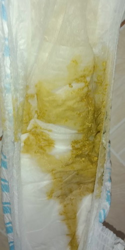 POOP NI BABY 😥😥