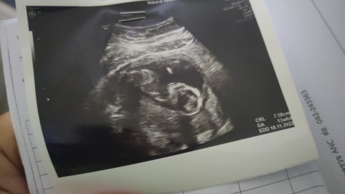 ขอคำปรึกษาค่ะ