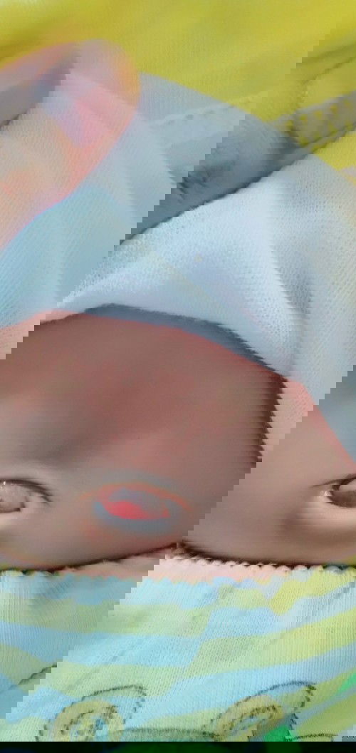 Hallo bunda:)..
D sini ada ga sih yg pernah ngalamin granuloma pada puser bayi ? Mohon bantuannya bu