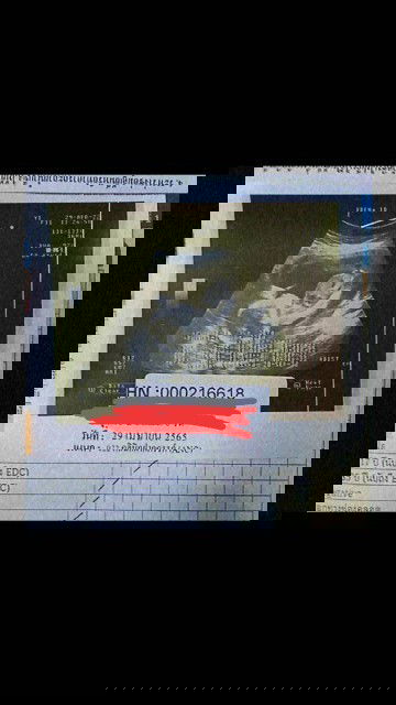 แม่ๆว่าน้องท้องโตไปไหมคะ