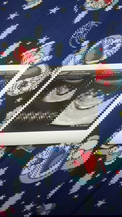 Buah buahan yang bagus untuk ibu hamil