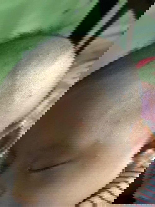 Wajah dan kepala bendol kecil