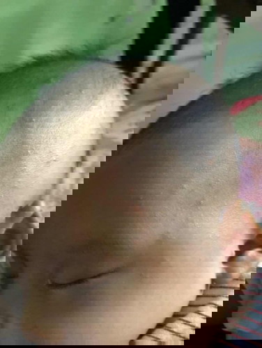 Wajah dan kepala bendol kecil