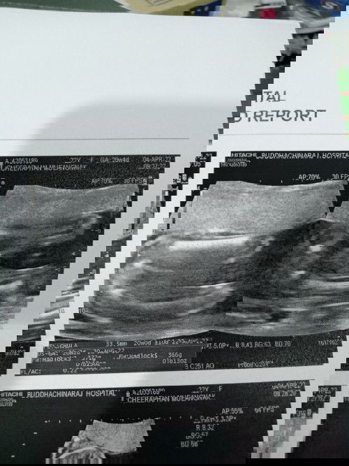 แม่ๆช่วยดูหน่อยคะ