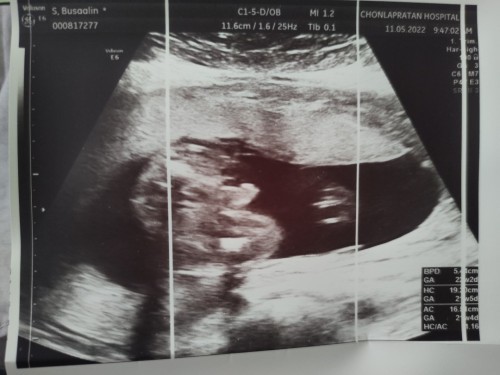 แม่ๆช่วยตั้งชื่อให้หน่อยค่าา