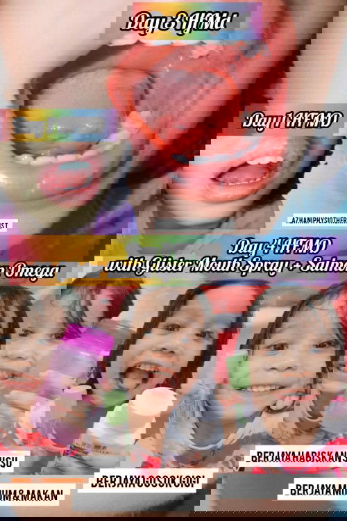 Cara Saya tangani anak HFMD #hfmd