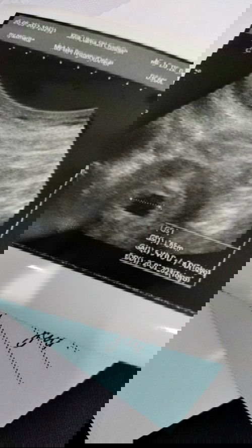 USG Kehamilan 5 minggu