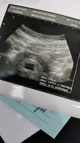 USG Kehamilan 5 minggu
