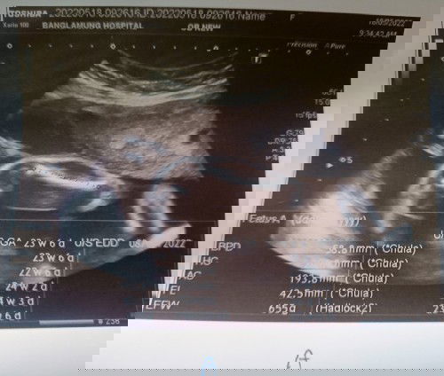 น้องแฝด 26 w