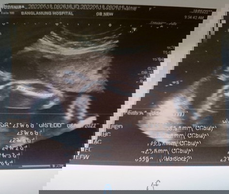 น้องแฝด 26 w