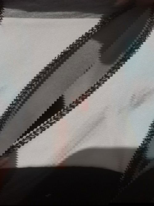 NORMAL LANG PO BA ITO?