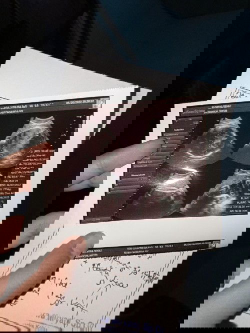 Bagi tips biar cepet masuk panggul dong