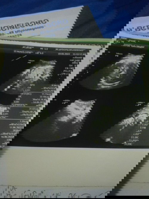 Hpl sesuai hpht 16 juni