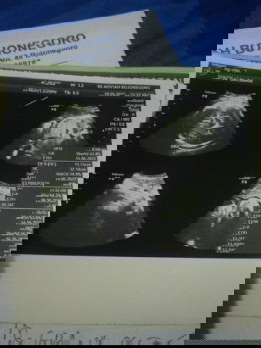 Hpl sesuai hpht 16 juni