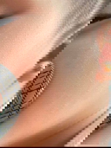 Bungang araw? Not sure