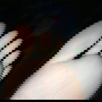 Telapak kaki nyeri dan kaku