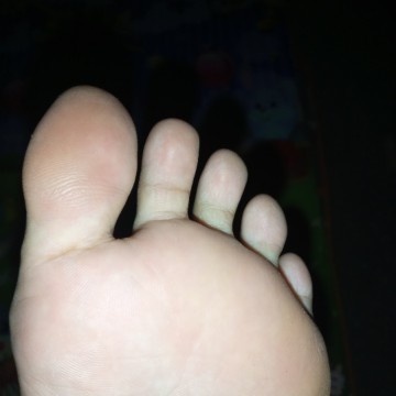 Telapak kaki nyeri dan kaku