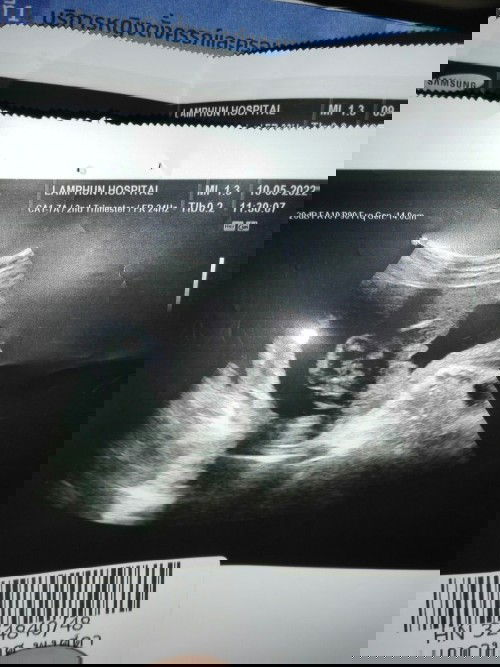 แบบนี้ชายหรือหญิงค่ะ