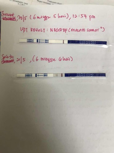 Positif line atau evaporation line.