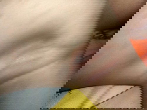 ผิวเป็นผื่นสากๆไม่คัน