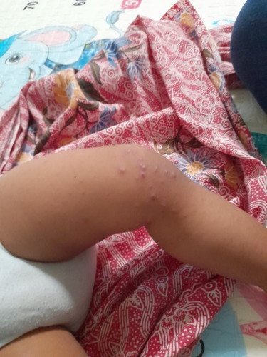 Obat yang bagus apa ya